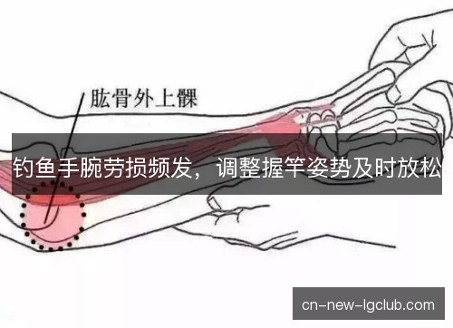 钓鱼手腕劳损频发，调整握竿姿势及时放松